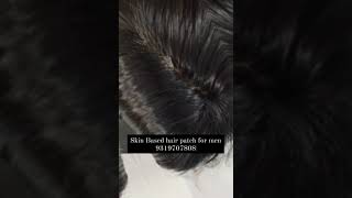 Skin Based Hair patch for men wig hairwig hairpatch hairpatchesformen hairpatchforsale yshort [upl. by Eniarral]