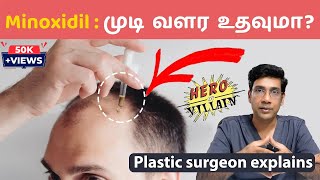 முடி வளர்ச்சிக்கு மினாக்ஸிடில் எப்படி பயன்படுத்துவது Minoxidil  Hair Loss clinic coimbatore [upl. by Esorylime54]