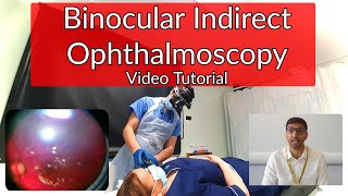 Binocular Indirect Ophthalmoscopy Tutorial [upl. by Dorey149]