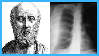 Top 12 Contributions of Hippocrates [upl. by Rennane590]