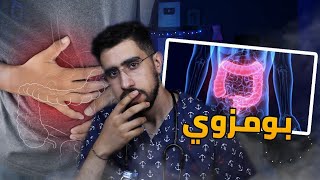 بومزوي اسبابه طرق العلاج والوقاية [upl. by Quinby]