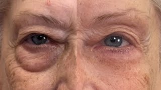 Get Rid of Eye Bags Instantly Eliminate Puffiness and Darkness 🚨 Fierce Aging with Nikol Johnson [upl. by Alleusnoc]