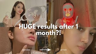 I tried an LED mask for 1 month  Project E Light AuraFlex LED Mask HONEST REVIEW [upl. by Chura]