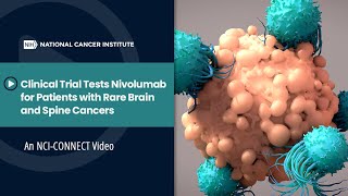 Clinical Trial Tests Nivolumab for Patients with Rare Brain and Spine Cancers [upl. by Marlie]