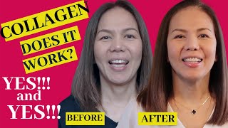 COLLAGEN Benefits  Does it really work [upl. by Ylam488]