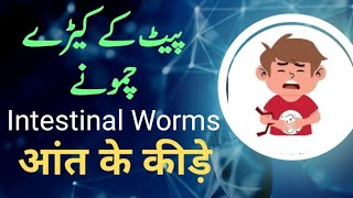 Homoeopathic Treatment for Intestinal WormsWhat is the best treatment [upl. by Akirat524]