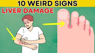 WARNING 10 Weird Signs Of LIVER DAMAGE that Your Body is Asking for Help  Daily Joy [upl. by Airtal432]