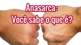 Anasarca Significado  O que é  Causas e Tratamentos [upl. by Ric]