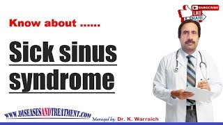 Sick sinus syndrome SSS  Causes Diagnosis Symptoms Treatment Prognosis [upl. by Etnaud]