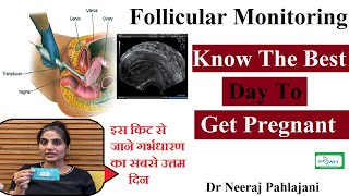 Follicular Study in Hindi  Dr Neeraj Pahaljani [upl. by Tadeo]