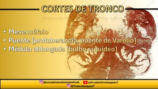 NEUROANATOMÍA  CORTES DE TRONCO Mesencéfalo puente médula oblongada bulbo raquídeo [upl. by Snah]