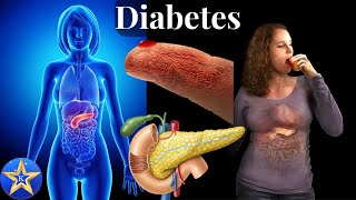 Diabetes Causes Diagnosis and Treatment [upl. by Rieth707]