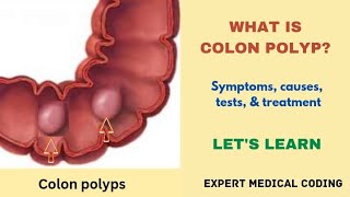 What is colon polyp TypesSymptomsCausesComplicationsTestsTreatmentPrecautionsMedical coding [upl. by Eedyak]