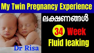 Twin Pregnancy Experience Malayalam  Twin Pregnancy Symptoms Before Period Malayalam [upl. by Celia]