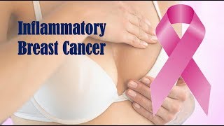 Inflammatory Breast Cancer [upl. by Ventura]