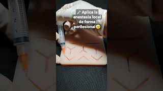 Aplica de esta forma la anestesia local si deseas suturar heridas pequeñas [upl. by Uokes152]