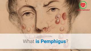 What is Pemphigus Causes Pictures Images Signs and Symptoms of Pemphigus Vulgaris [upl. by Irb]