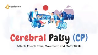 Dyskinetic Cerebral Palsy treatment [upl. by Aniles427]