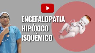 Encefalopatía hipóxicoisquémica  REDVENEO [upl. by Trik172]