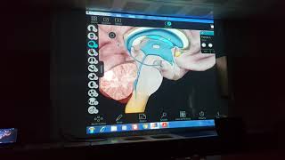 Ventriculus cerebriBeyin Ventrikülleri Anatomisi 3D Atlas üzerinden anlatımNöroanatomi [upl. by Francie244]