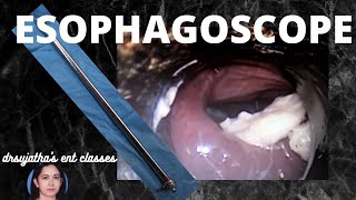 104Rigid esophagoscopy  Indication Contraindication Procedure steps oesophagus scopy [upl. by Cod]