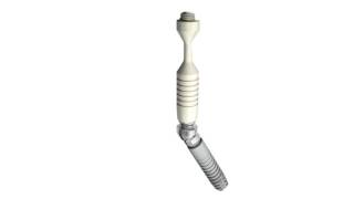 Ankylos® SmartFix – Prosthetic solution on tilted implants  Dentsply Sirona [upl. by Dylan209]