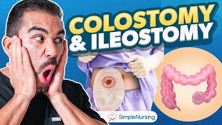 Colostomy and Ileostomy Nursing  Indications Complications Care EASY [upl. by Kilby244]