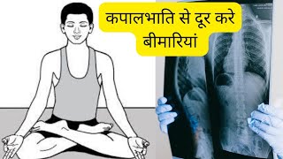 Benefits of Kapalbhati Yog l कपालभाति योग के फायदे kapalbhati yoga ramdev youtube Giantinfo [upl. by Anir134]