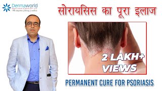 सोरायसिस का पूरा इलाज  Permanent Cure for Psoriasis  Dr Rohit Batra  In Hindi [upl. by Eanahc869]