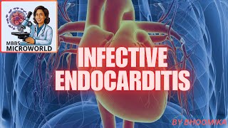 INFECTIVE ENDOCARDITIS [upl. by Doi402]