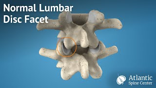 Normal Lumbar Disc Facet [upl. by Neirrad612]