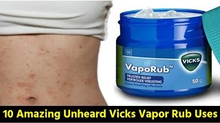 १० फायदे विक्स वेपोरब के  Amazing Benefits Of Vicks Vaporub [upl. by Mello]