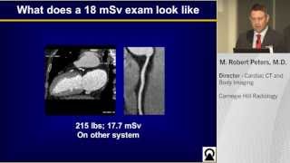 SCCT 2013 Cardiac CT with Aquilion PRIME 160 [upl. by Kellina]