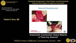 Anastomotic construction Suture material  Is there any science [upl. by Arlen]