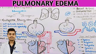 pulmonary edema pathophysiology in Hindi  cardiogenic pulmonary edema [upl. by Yasui373]