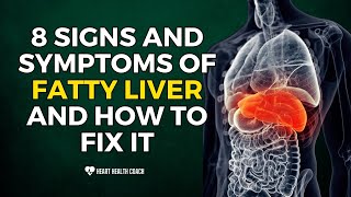 8 Signs and Symptoms of Fatty Liver and How to Fix It [upl. by Atinyl]