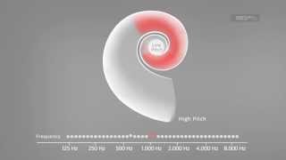 Sound Stimulates the Cochlea  MEDEL [upl. by Arodoet371]