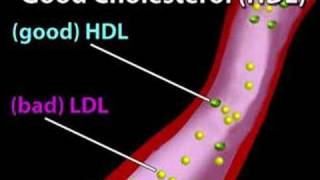 Understanding Cholesterol Cholesterol 1 [upl. by Portugal209]