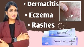 Dermoline Cream uses for eczemaDermatitisdry skin and rashes  Best cream for skin disease [upl. by Alberik639]