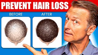 12 Proven Remedies to Prevent Hair Loss and Regrowth Regrow hair [upl. by Arne]