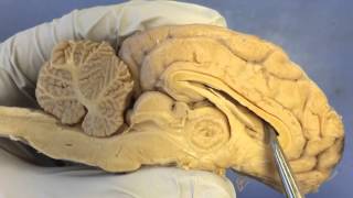 Sheep Brain Dissection Anatomy and Function [upl. by Anelram801]