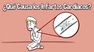 ¿Que Causa los Infartos Cardiacos [upl. by Nnaecyoj84]