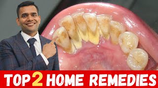 Top 2 Remedies To Remove Dental Plaque  Remove Dental Plaque and keep Oral Hygiene Healthy At Home [upl. by Kwok214]