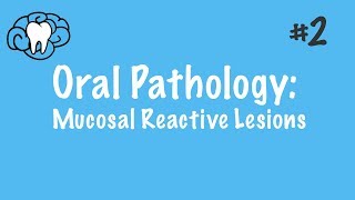 Oral Pathology  Mucosal Reactive Lesions  INBDE ADAT [upl. by Rolando]