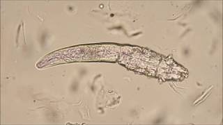 Demodex canis mites [upl. by Taite946]