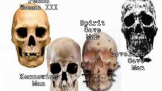 3 Basic Human Skulls [upl. by Treve442]