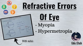 Fundus findings  pathological myopia [upl. by Cheung]