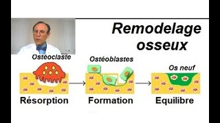 Ostéoporose amp Ostéopénie vertébrales  Traitement naturel sans médicament [upl. by Otsirave707]