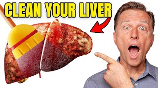 Top BEST Foods to Clean Out Your Liver [upl. by Nadeau]