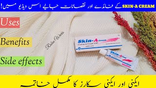 SkinA Cream Uses Benefits and Side effects Review  How to use SkinA cream  Tretinoin 005 [upl. by Severson231]